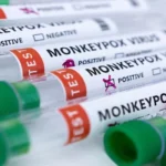 WHO declares monkeypox a global health emergency